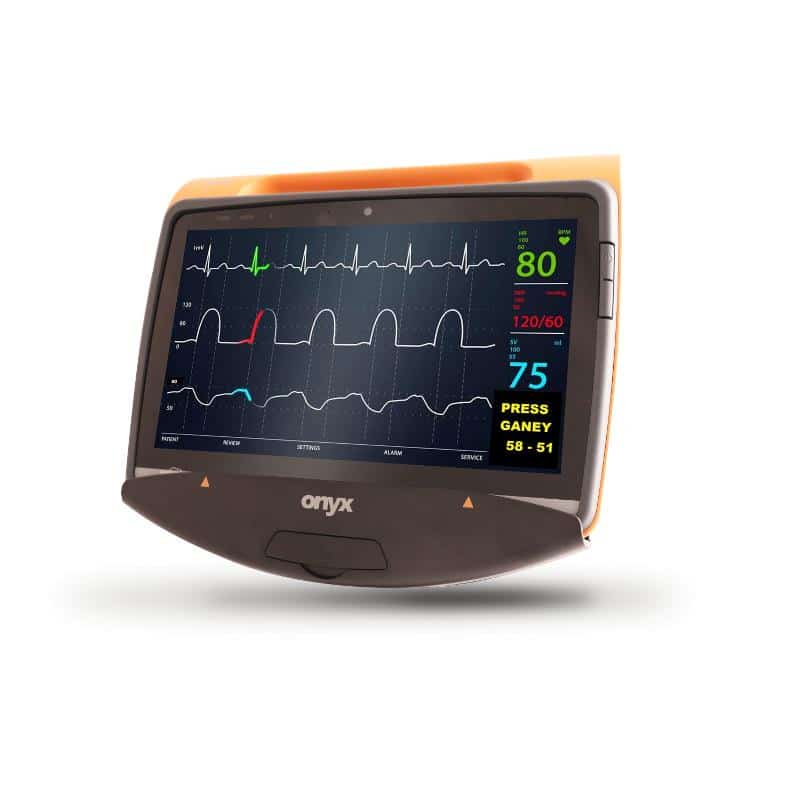 Medical monitor shows heart rate and blood pressure readings